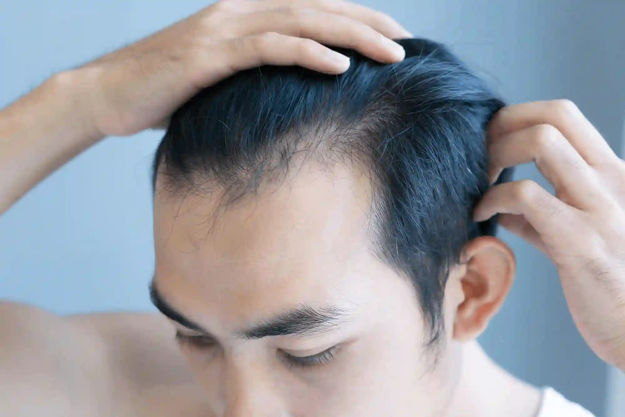 hair loss treatment in kolkata by Dr debatri Datta